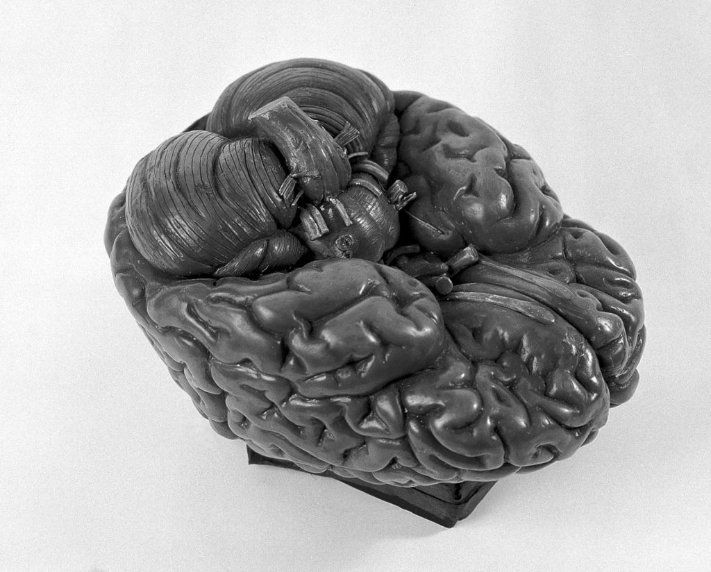 A researcher examining brain scan images in a laboratory
